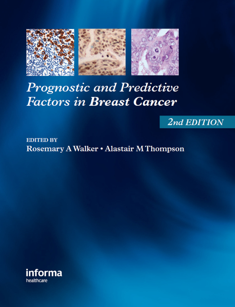 Cover image for book Prognostic and Predictive Factors in Breast Cancer