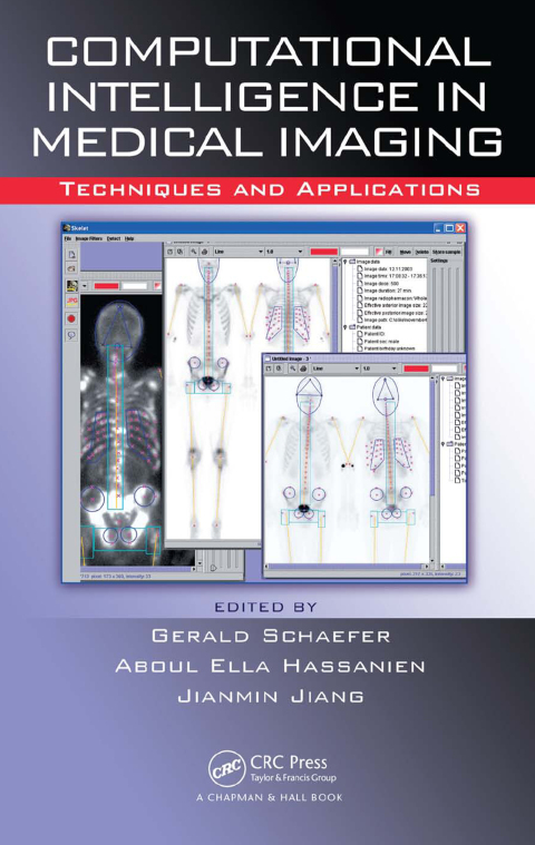 Cover image for book Computational Intelligence in Medical Imaging