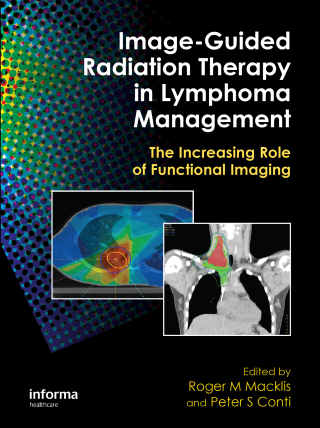 Image-Guided Radiation Therapy in Lymphoma Management
