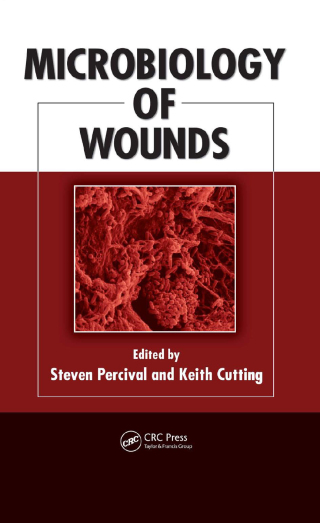 Microbiology of Wounds