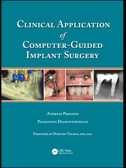 Cover image for book Clinical Application of Computer-Guided Implant Surgery