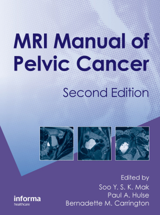MRI Manual of Pelvic Cancer,Second Edition