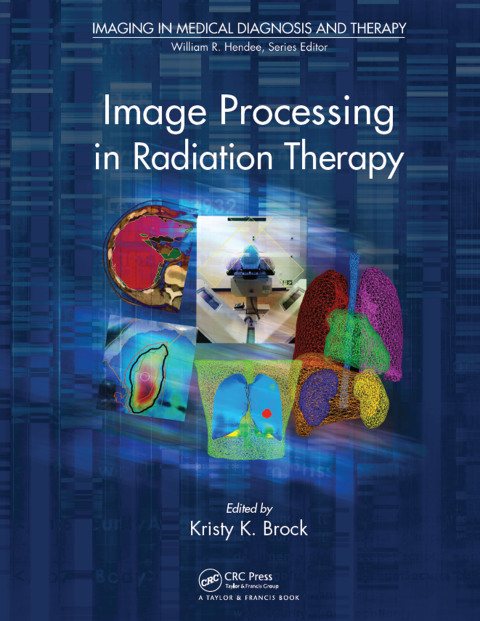 Cover image for book Image Processing in Radiation Therapy