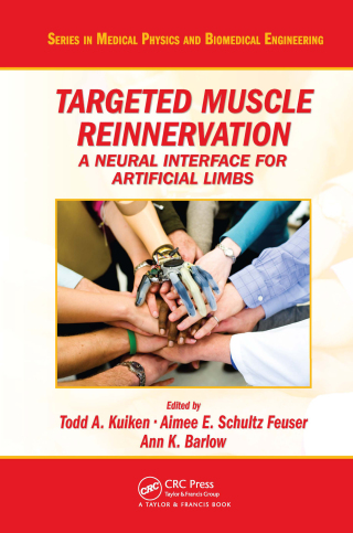 Targeted Muscle Reinnervation