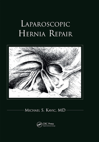 Laparoscopic Hernia Repair
