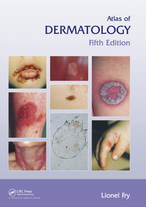 Atlas of Dermatology, Fifth Edition 