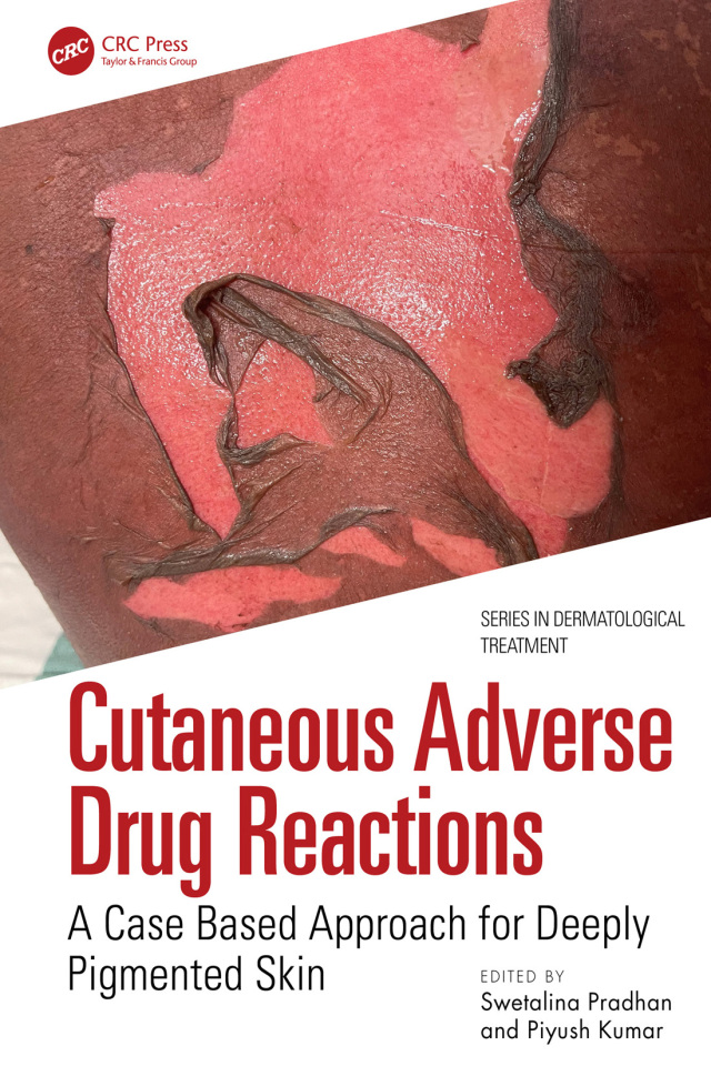 Cutaneous Adverse Drug Reactions