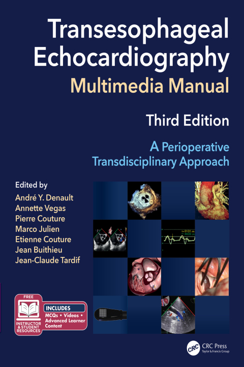 Cover image for book Transesophageal Echocardiography Multimedia Manual