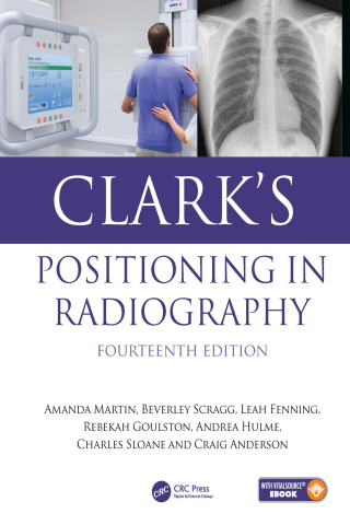 Clark's Positioning in Radiography