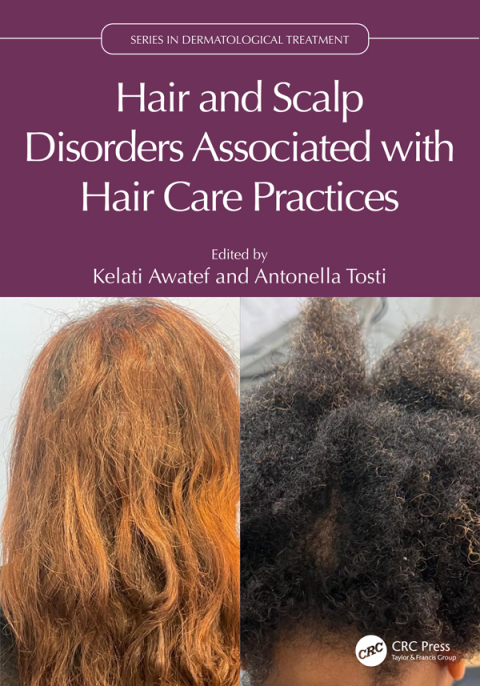 Cover image for book Hair and Scalp Disorders Associated with Hair Care Practices