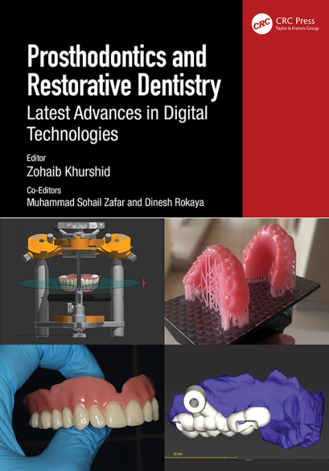 Cover image for book Prosthodontics and Restorative Dentistry