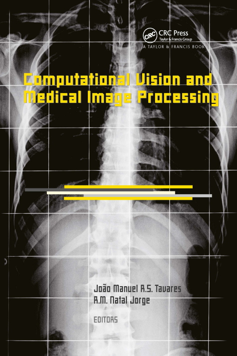 Cover image for book Computational Vision and Medical Image Processing