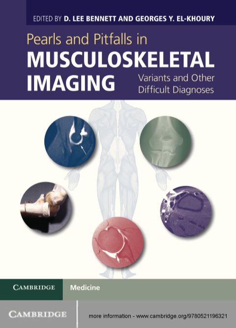 Cover image for book Pearls and Pitfalls in Musculoskeletal Imaging