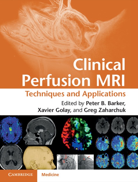 Clinical Perfusion MRI 