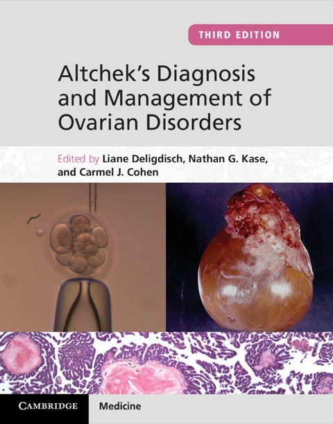 Cover image for book Altchek's Diagnosis and Management of Ovarian Disorders