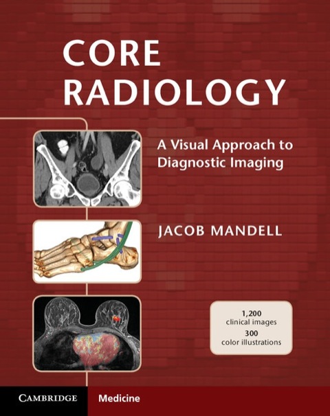 Cover image for book Core Radiology
