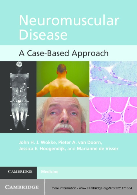 Cover image for book Neuromuscular Disease