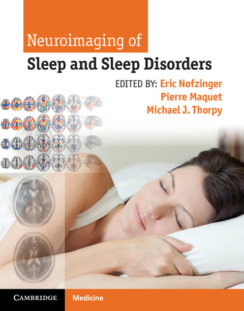 Cover image for book Neuroimaging of Sleep and Sleep Disorders
