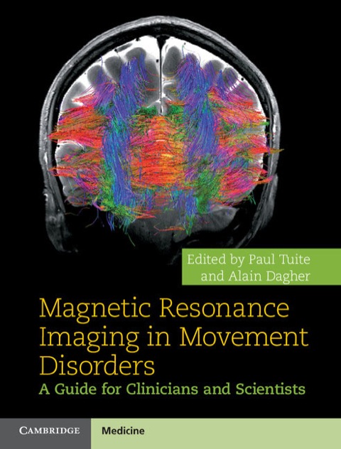 Cover image for book Magnetic Resonance Imaging in Movement Disorders