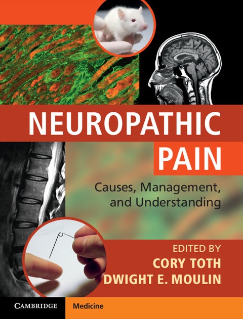 Cover image for book Neuropathic Pain