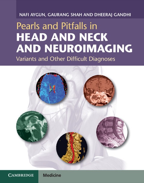 Cover image for book Pearls and Pitfalls in Head and Neck and Neuroimaging