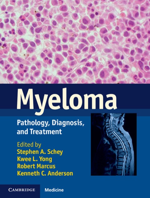Cover image for book Myeloma