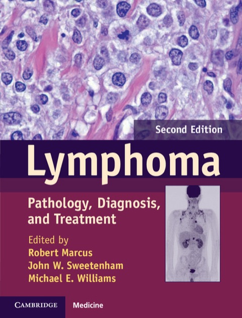 Cover image for book Lymphoma