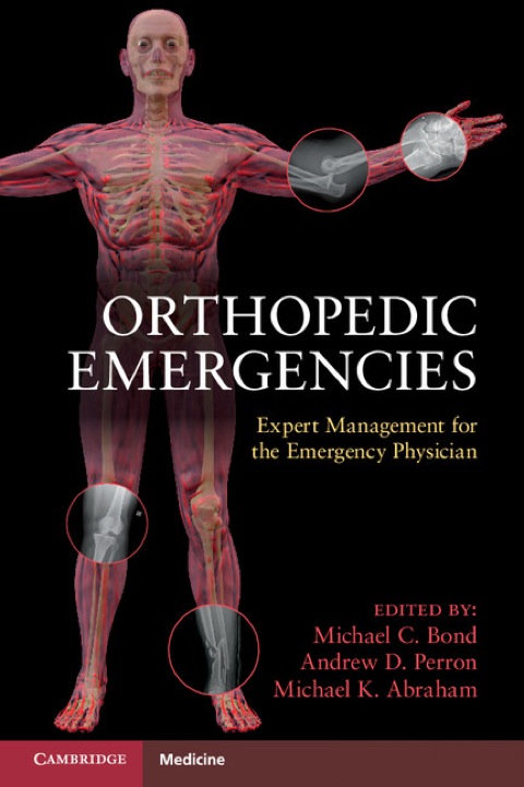 Orthopedic Emergencies 