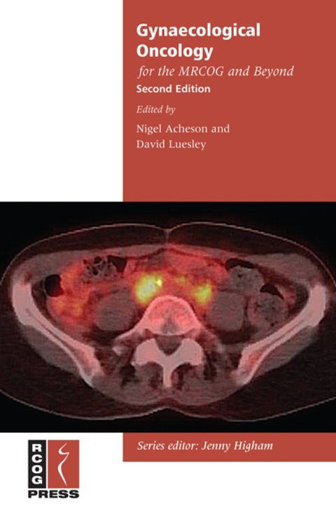 Cover image for book Gynaecological Oncology for the MRCOG and Beyond