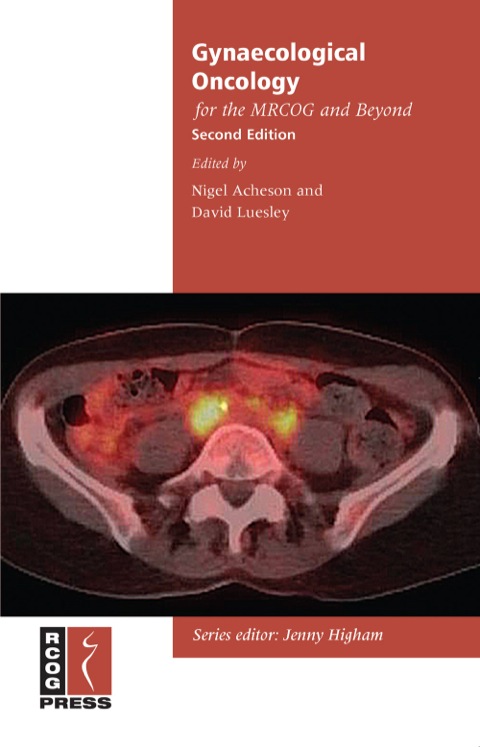 Cover image for book Gynaecological Oncology for the MRCOG and Beyond