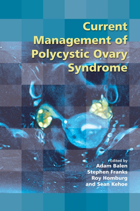 Cover image for book Current Management of Polycystic Ovary Syndrome