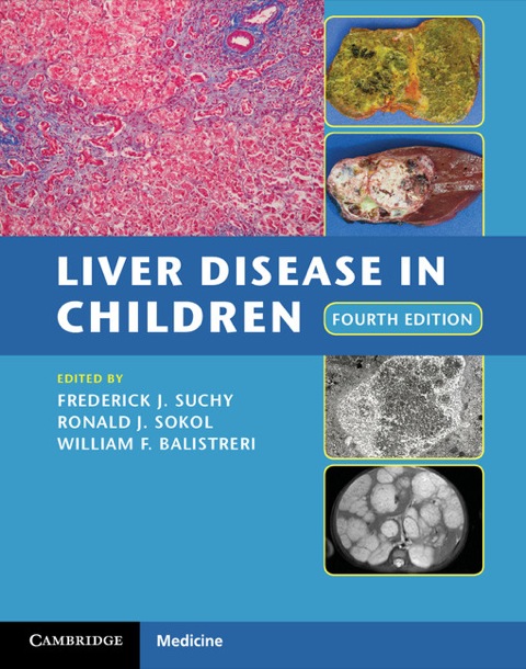 Cover image for book Liver Disease in Children