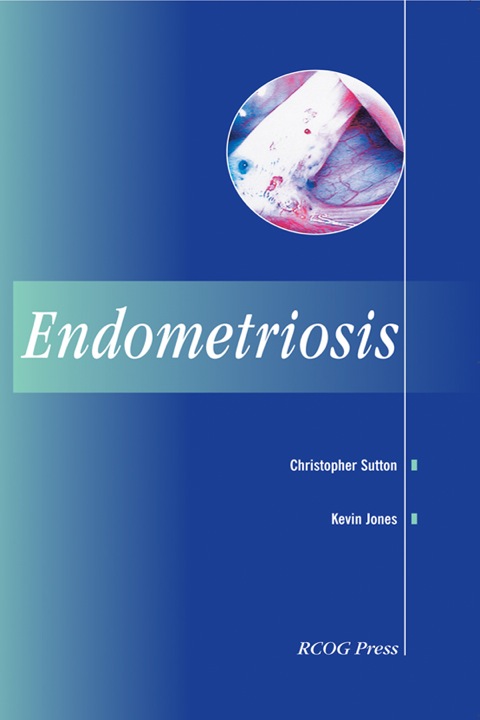 Cover image for book Endometriosis