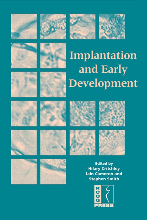Cover image for book Implantation and Early Development