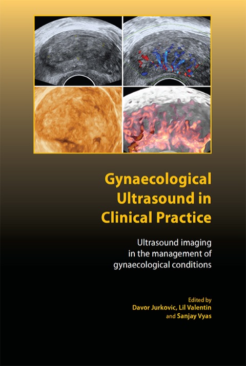 Cover image for book Gynaecological Ultrasound in Clinical Practice