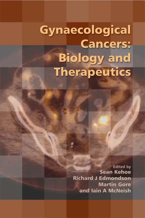 Cover image for book Gynaecological Cancers