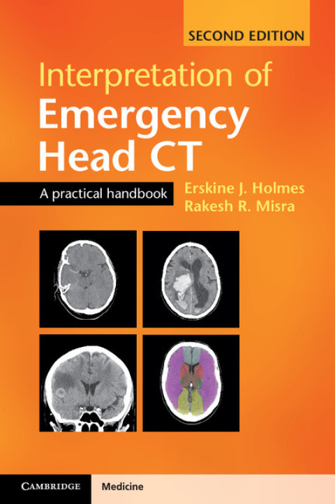 Cover image for book Interpretation of Emergency Head CT