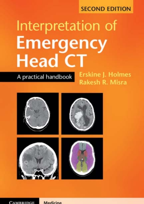 Cover image for book Interpretation of Emergency Head CT