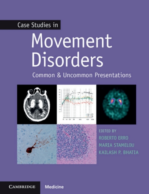 Cover image for book Case Studies in Movement Disorders