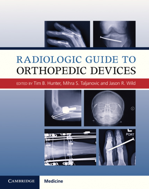Cover image for book Radiologic Guide to Orthopedic Devices