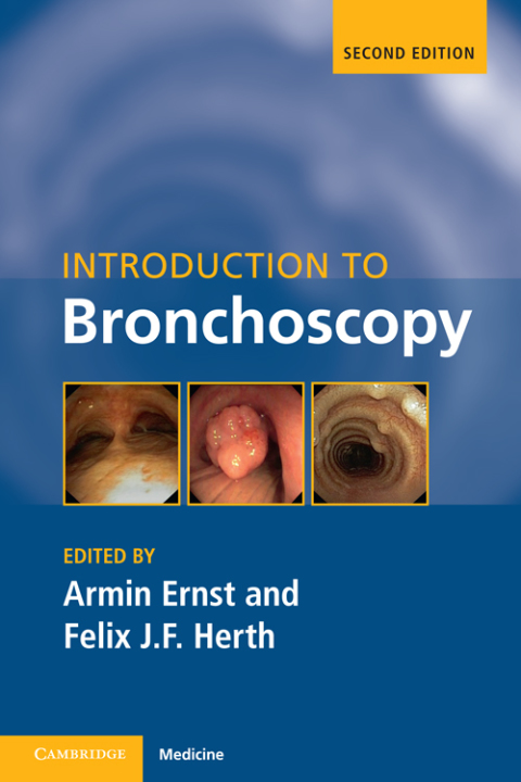 Cover image for book Introduction to Bronchoscopy