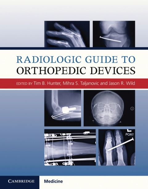 Cover image for book Radiologic Guide to Orthopedic Devices