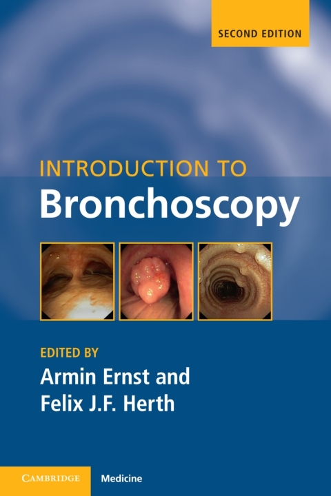 Cover image for book Introduction to Bronchoscopy