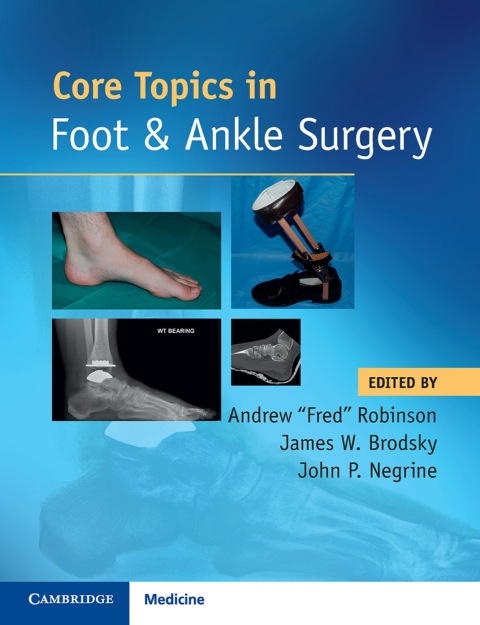 Cover image for book Core Topics in Foot and Ankle Surgery