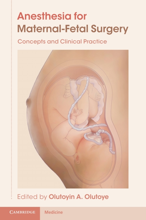 Cover image for book Anesthesia for Maternal-Fetal Surgery