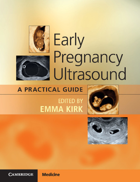 Cover image for book Early Pregnancy Ultrasound
