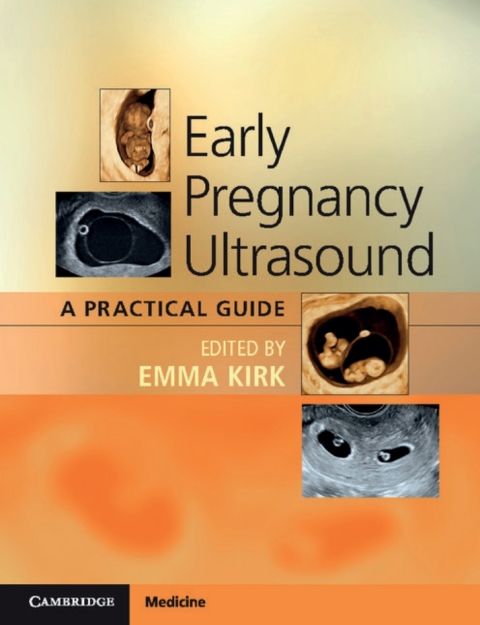 Cover image for book Early Pregnancy Ultrasound