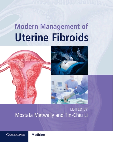 Cover image for book Modern Management of Uterine Fibroids