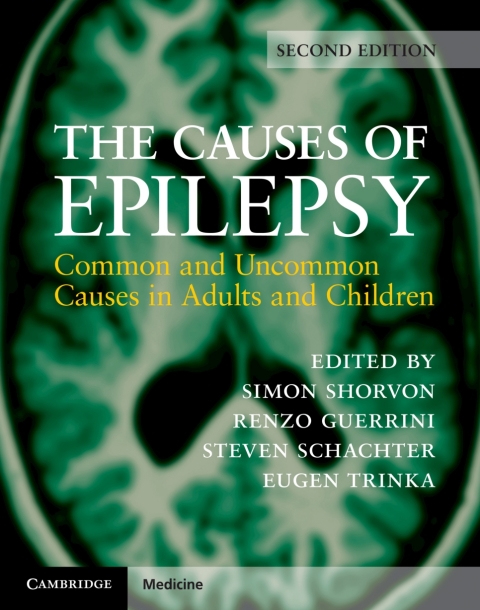 Cover image for book The Causes of Epilepsy