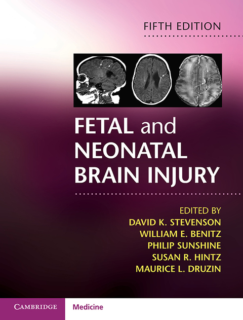 Cover image for book Fetal and Neonatal Brain Injury